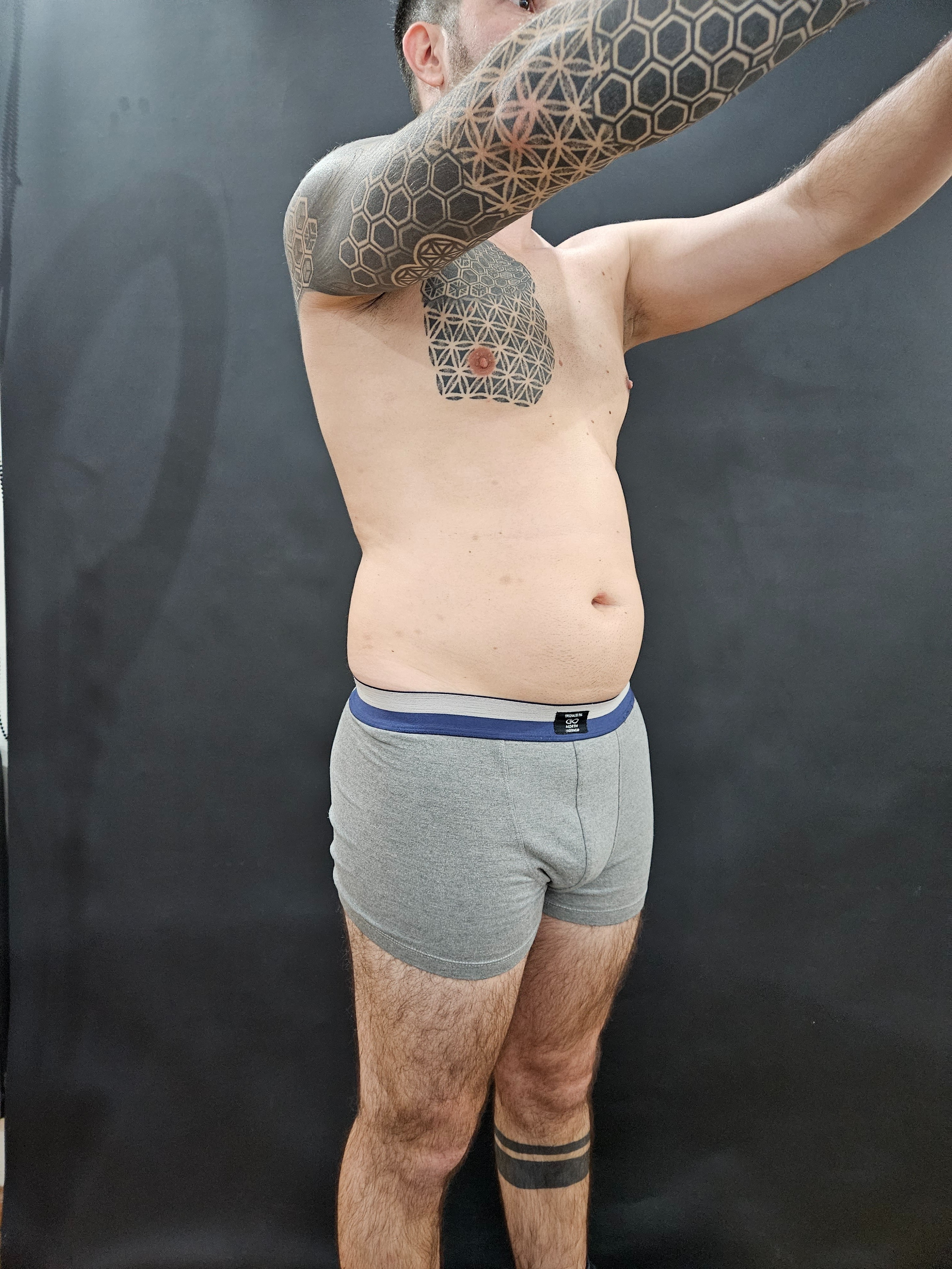 Antes — abdomen